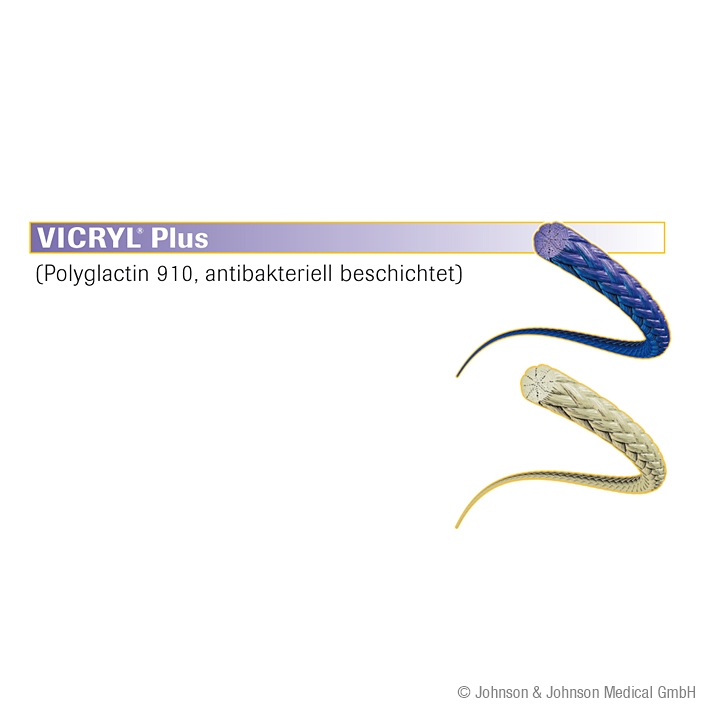 VICRYL Plus PS2 VB 3/0=2 ungefärbt Nahtmaterial Fadenlänge 45 cm (36 Stck.)